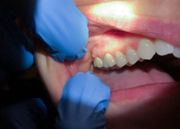 Best Emergency Dental Surgery in Rio Grande, NJ
