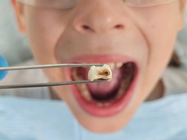 Best Pediatric Emergency Dentist in Rio Grande, NJ